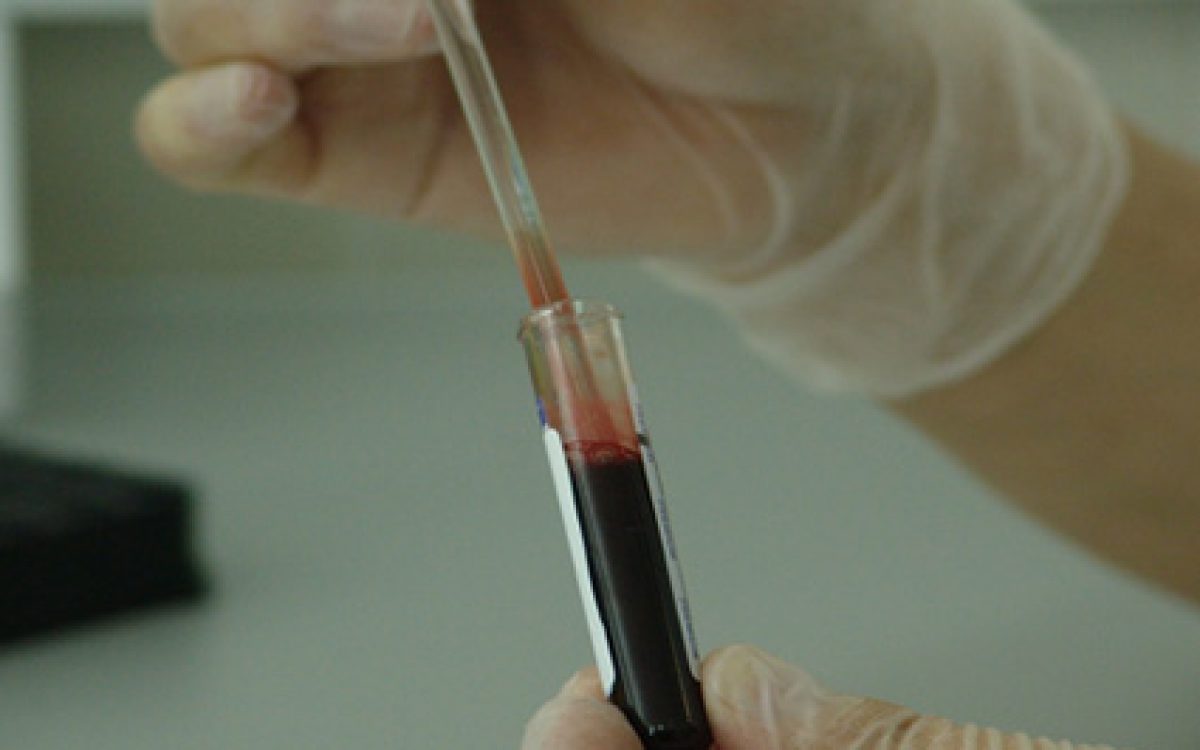 zika-virus