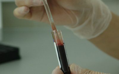 zika-virus